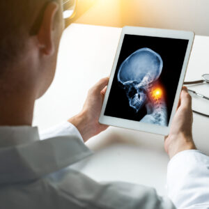 Fisioterapia Oncológica no Câncer de Cabeça e Pescoço