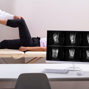 Fisioterapia nos Tumores Osteomusculares